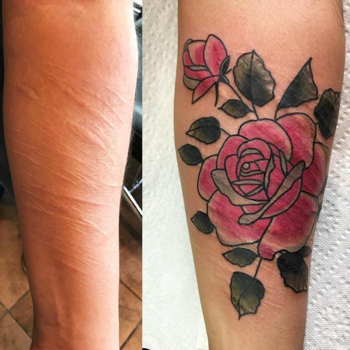 Татуировки на шрамах на руке